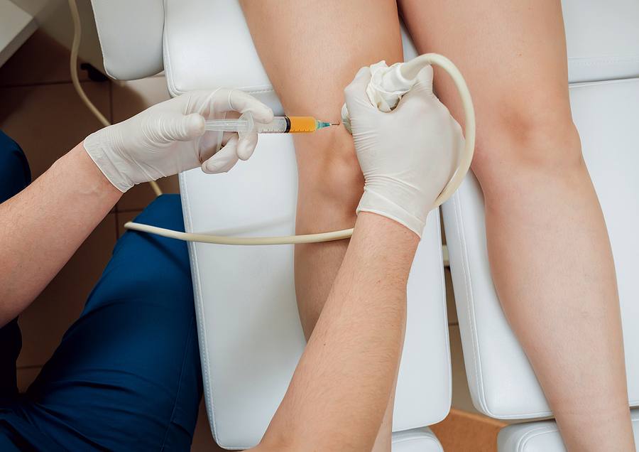 Ultrasound-Guided Injections